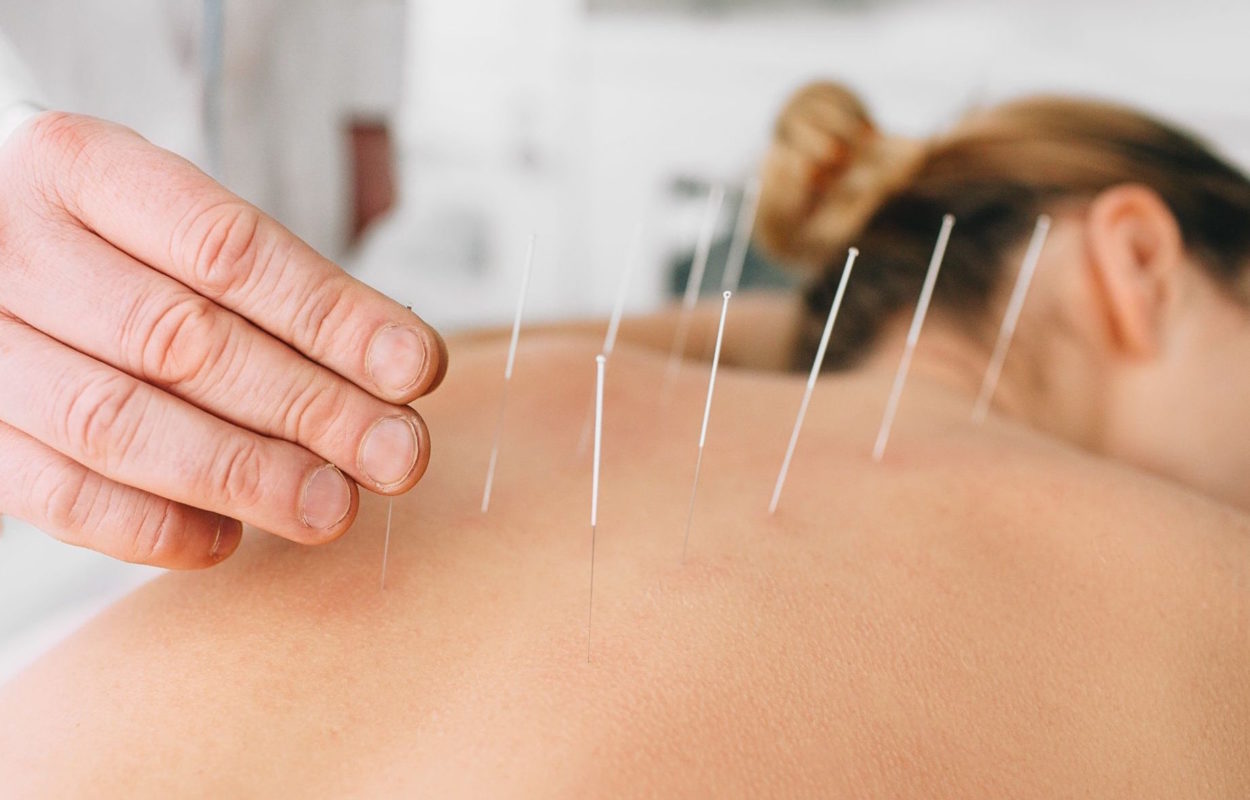 Acupuncture : Le Guide Complet - Medecine Chine